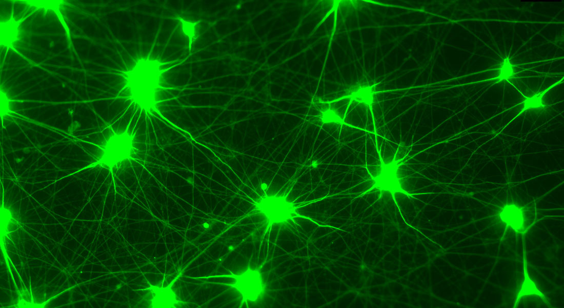 iPSC-induced neuron
