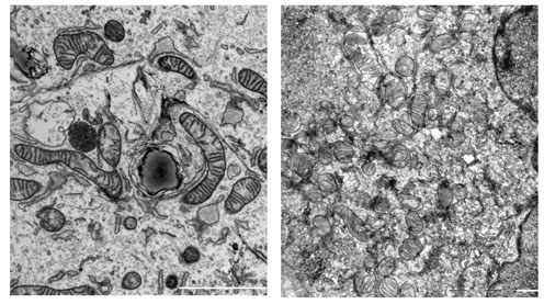 Transmission electron microscopy images 