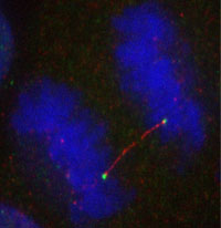 photo of a cell in anaphase 