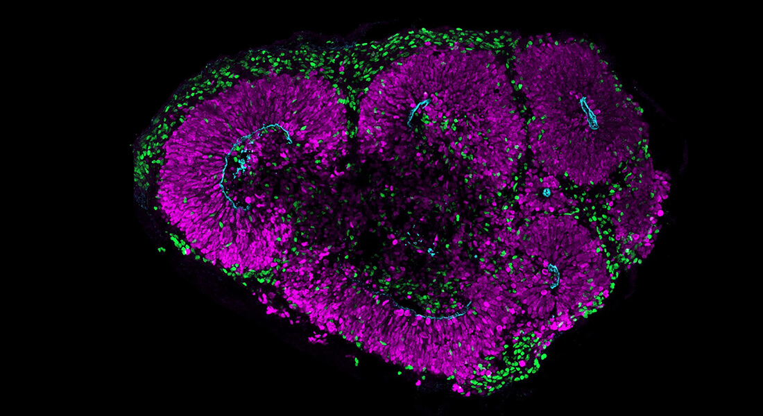 A microscopy image showing a human brain organoid